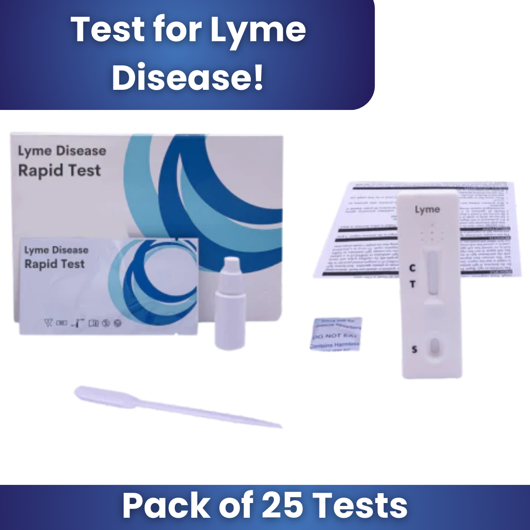 SpecCheck Lyme Disease Rapid Test (25 Tests/Kit)