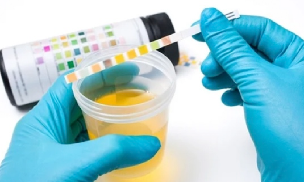Rapid Urinechem Test (5 Bottles/Package)
